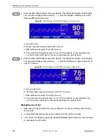 Preview for 122 page of Nellcor OXIMAX N-600X Series Service Manual