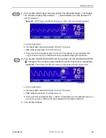 Preview for 129 page of Nellcor OXIMAX N-600X Series Service Manual