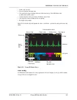 Preview for 45 page of ZOLL Propaq MD Operator'S Manual