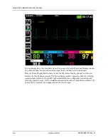 Preview for 64 page of ZOLL Propaq MD Operator'S Manual