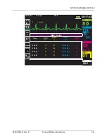 Preview for 65 page of ZOLL Propaq MD Operator'S Manual