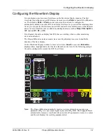 Preview for 67 page of ZOLL Propaq MD Operator'S Manual