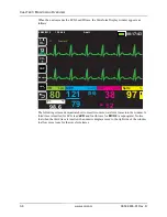 Preview for 68 page of ZOLL Propaq MD Operator'S Manual