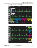 Preview for 69 page of ZOLL Propaq MD Operator'S Manual