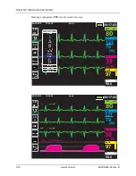 Preview for 70 page of ZOLL Propaq MD Operator'S Manual