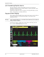 Preview for 78 page of ZOLL Propaq MD Operator'S Manual