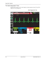 Preview for 80 page of ZOLL Propaq MD Operator'S Manual