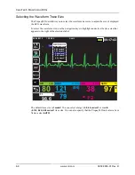 Preview for 92 page of ZOLL Propaq MD Operator'S Manual