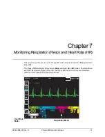 Preview for 95 page of ZOLL Propaq MD Operator'S Manual