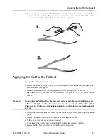 Preview for 111 page of ZOLL Propaq MD Operator'S Manual