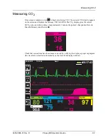 Preview for 127 page of ZOLL Propaq MD Operator'S Manual