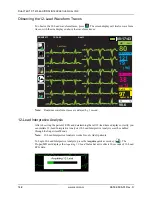 Preview for 178 page of ZOLL Propaq MD Operator'S Manual