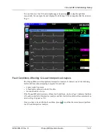 Preview for 181 page of ZOLL Propaq MD Operator'S Manual