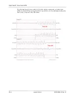 Preview for 232 page of ZOLL Propaq MD Operator'S Manual