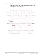 Preview for 234 page of ZOLL Propaq MD Operator'S Manual