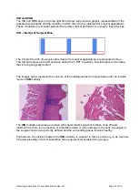 Preview for 41 page of K-LASER Blue Derma Operating	 Instruction