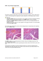 Preview for 42 page of K-LASER Blue Derma Operating	 Instruction