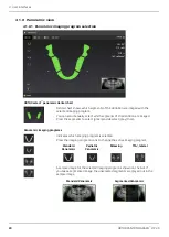 Предварительный просмотр 20 страницы KaVo ORTHOPANTOMOGRAPH OP 3D User Manual