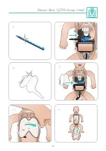 Preview for 25 page of laerdal Resusci Baby QCPR User Manual