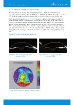 Предварительный просмотр 60 страницы OCULUS Pentacam Interpretation Manual