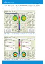 Предварительный просмотр 73 страницы OCULUS Pentacam Interpretation Manual