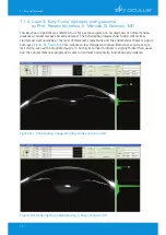 Предварительный просмотр 78 страницы OCULUS Pentacam Interpretation Manual