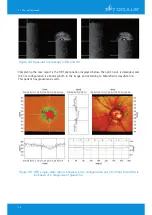 Предварительный просмотр 80 страницы OCULUS Pentacam Interpretation Manual