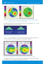 Предварительный просмотр 89 страницы OCULUS Pentacam Interpretation Manual