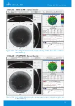 Предварительный просмотр 107 страницы OCULUS Pentacam Interpretation Manual