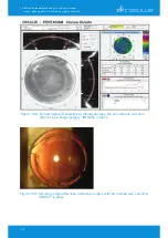 Предварительный просмотр 118 страницы OCULUS Pentacam Interpretation Manual