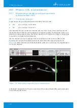 Предварительный просмотр 152 страницы OCULUS Pentacam Interpretation Manual