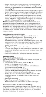 Preview for 8 page of Össur CTI CUSTOM Instructions For Use Manual