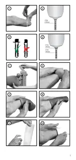 Предварительный просмотр 3 страницы Össur ICEROSS CUSHION Instructions For Use Manual