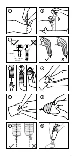 Предварительный просмотр 3 страницы Össur ICEROSS SEAL-IN X LOCKING Instructions For Use Manual