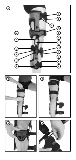 Preview for 3 page of Össur REBOUND ACL Technical Manual