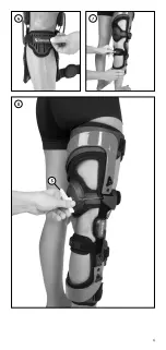 Preview for 4 page of Össur REBOUND ACL Technical Manual