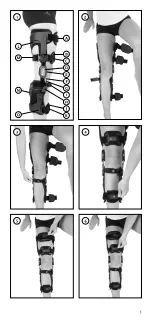 Preview for 3 page of Össur REBOUND PCL Technical Manual