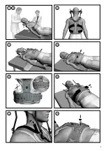 Preview for 4 page of Össur Resolve Technical Manual