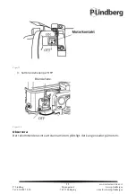 Preview for 35 page of P.Lindberg LS2 Instructions For Use Manual