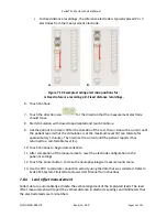 Preview for 55 page of SALUDA MEDICAL Evoke SCS System Clinical Manual