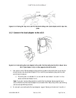 Preview for 75 page of SALUDA MEDICAL Evoke SCS System Clinical Manual