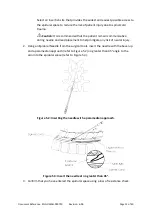 Preview for 13 page of SALUDA MEDICAL Evoke SCS System Surgical Manual