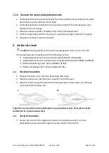 Preview for 15 page of SALUDA MEDICAL Evoke SCS System Surgical Manual