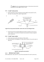 Preview for 16 page of SALUDA MEDICAL Evoke SCS System Surgical Manual