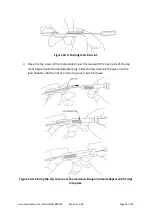 Preview for 25 page of SALUDA MEDICAL Evoke SCS System Surgical Manual