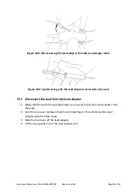 Preview for 29 page of SALUDA MEDICAL Evoke SCS System Surgical Manual