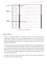 Preview for 7 page of TDT Medusa4Z User Manual