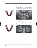 Предварительный просмотр 62 страницы Vatech PAX-I User Manual