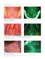 Preview for 3 page of Velscope VX Examination Manual