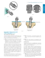 Предварительный просмотр 57 страницы Zimmer Biomet Persona Surgical Technique